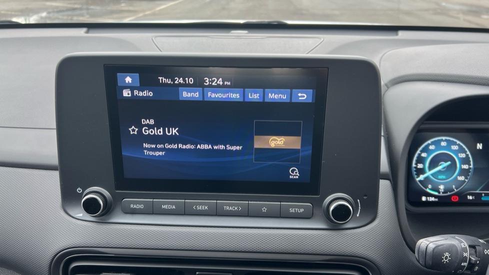 DAB Radio