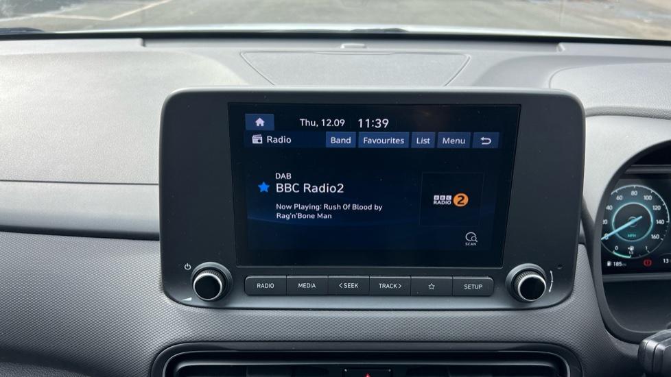 DAB Radio