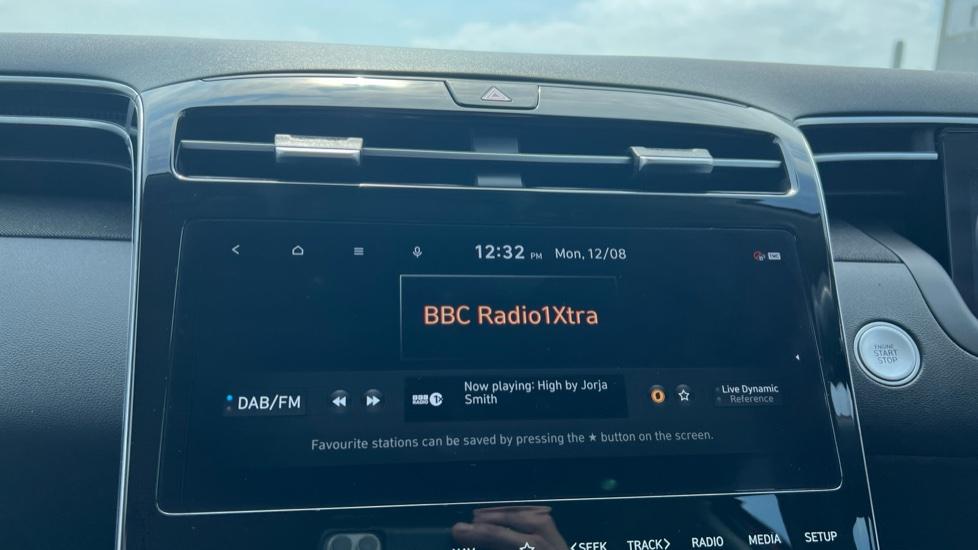 DAB Radio