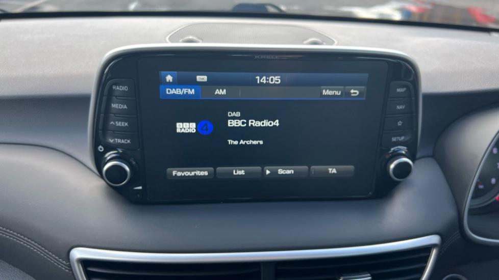 DAB Radio