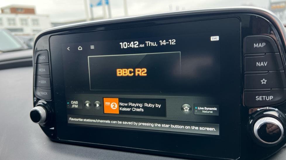 DAB Radio