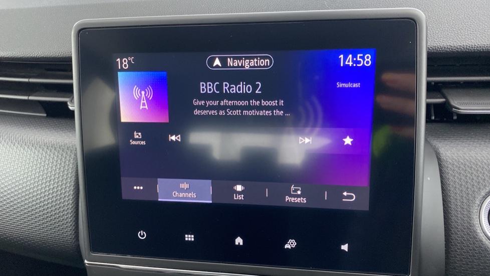 DAB radio 