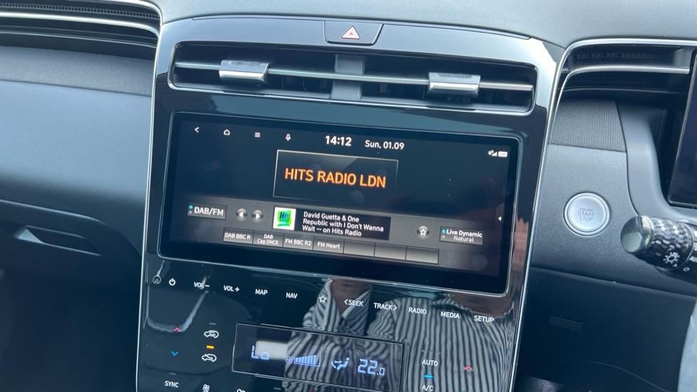 DAB Radio 