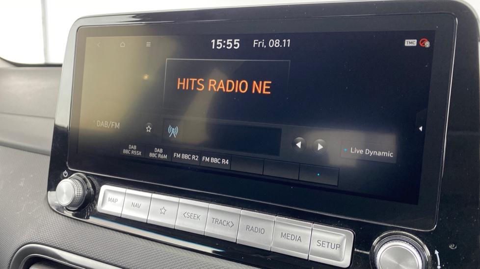 DAB Radio