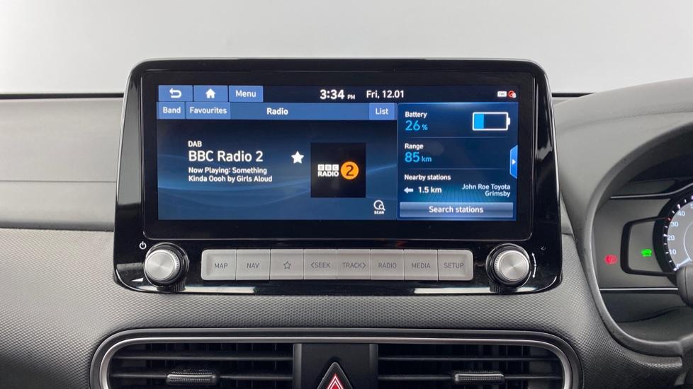 DAB Radio