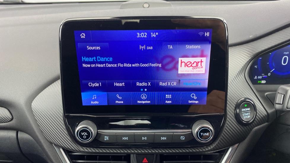 DAB Radio