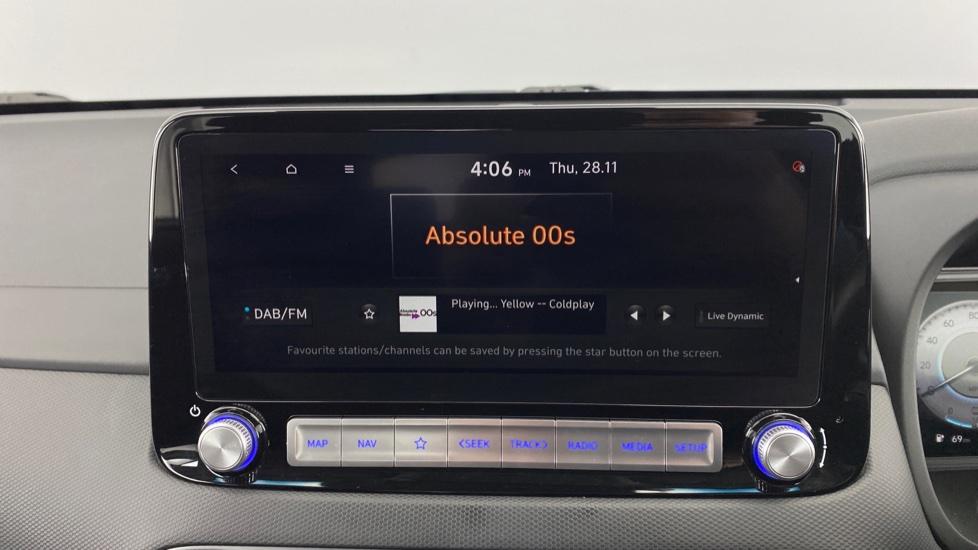 DAB Radio