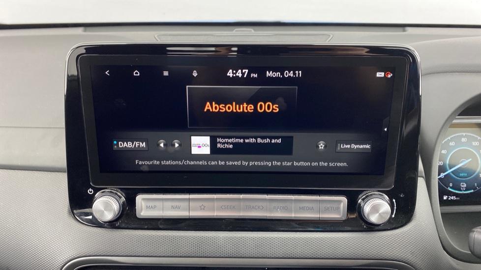 DAB Radio