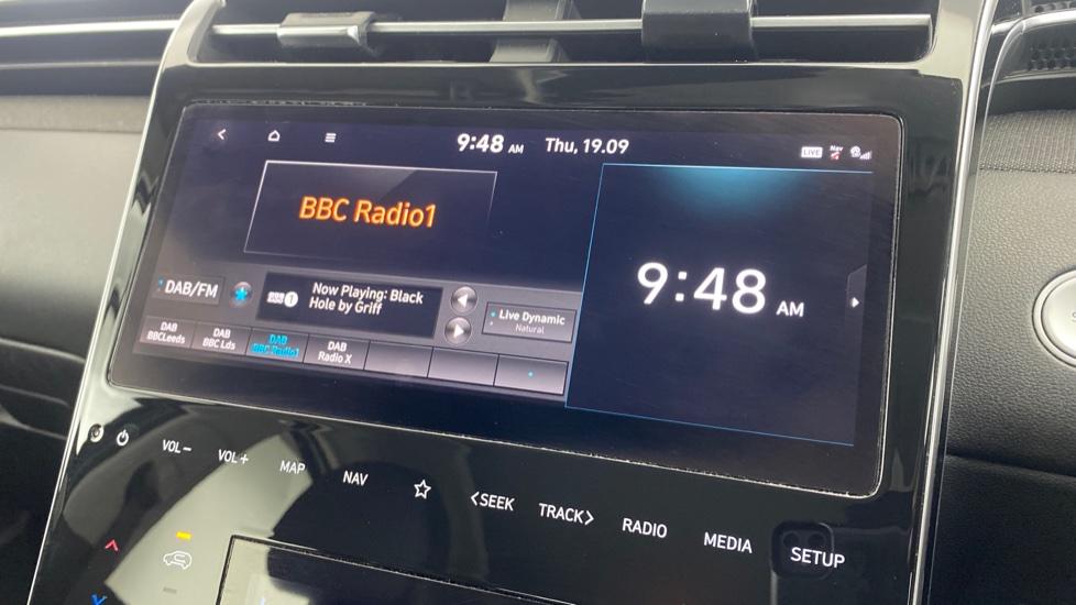 DAB Radio