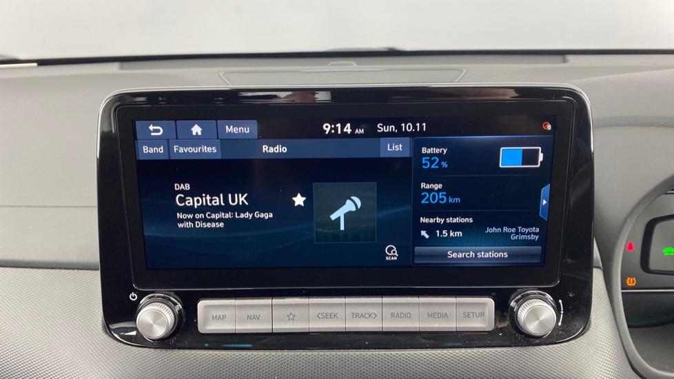 DAB Radio