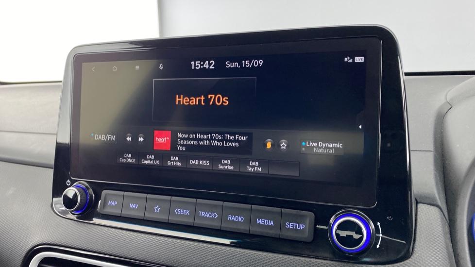 DAB Radio