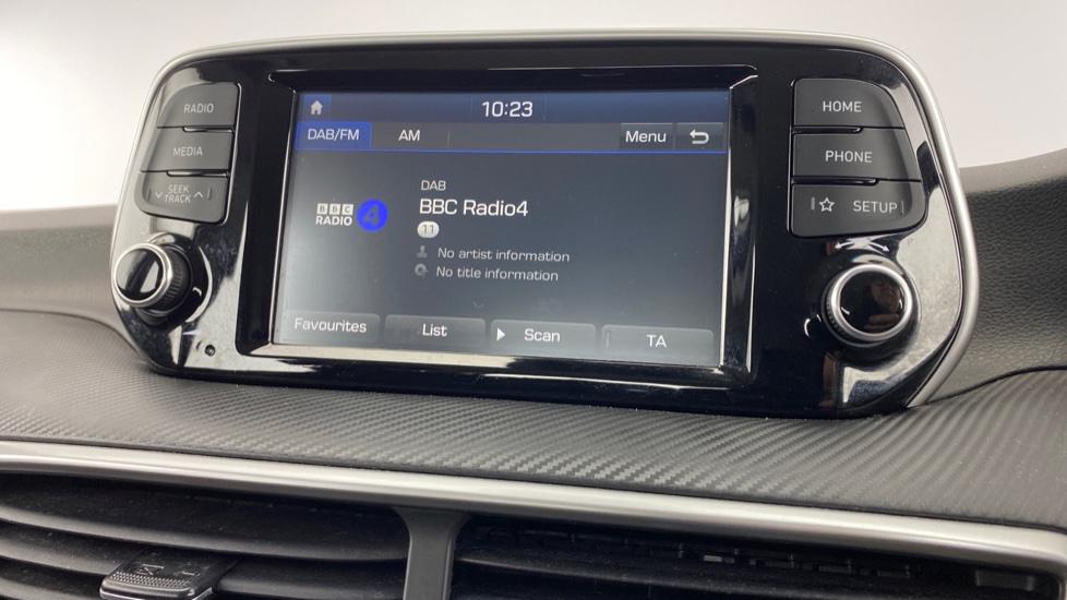 DAB Radio