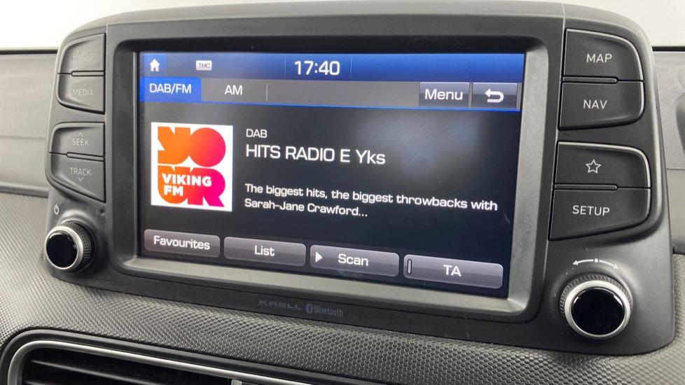 DAB Radio