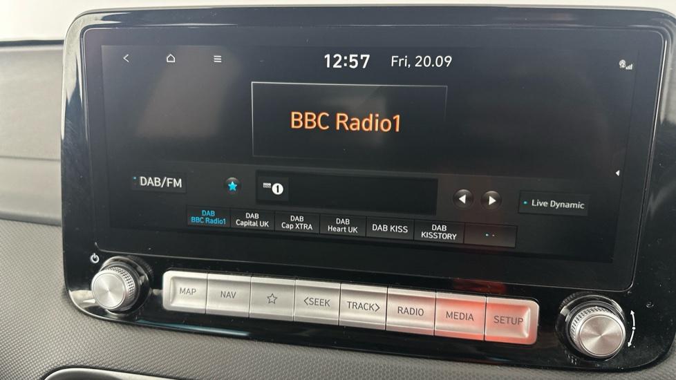 DAB Radio