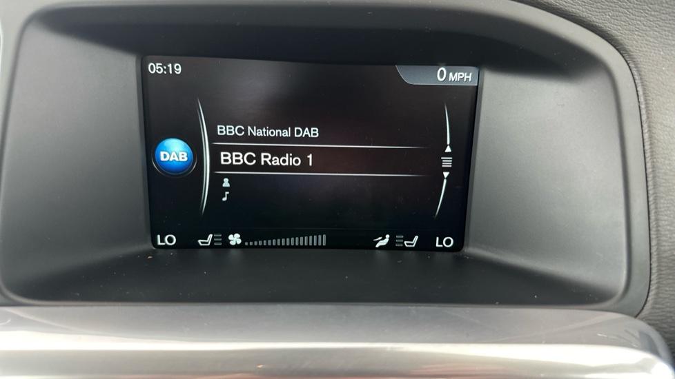 DAB Radio