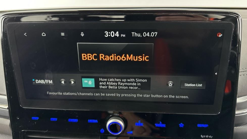 DAB Radio