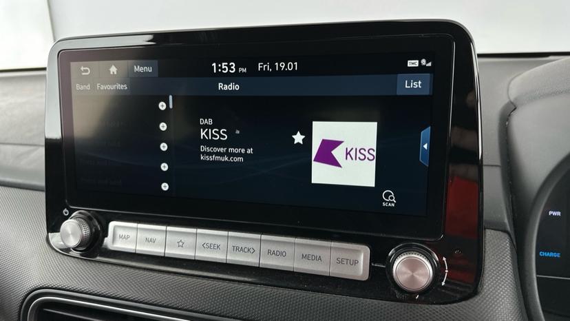 DAB Radio