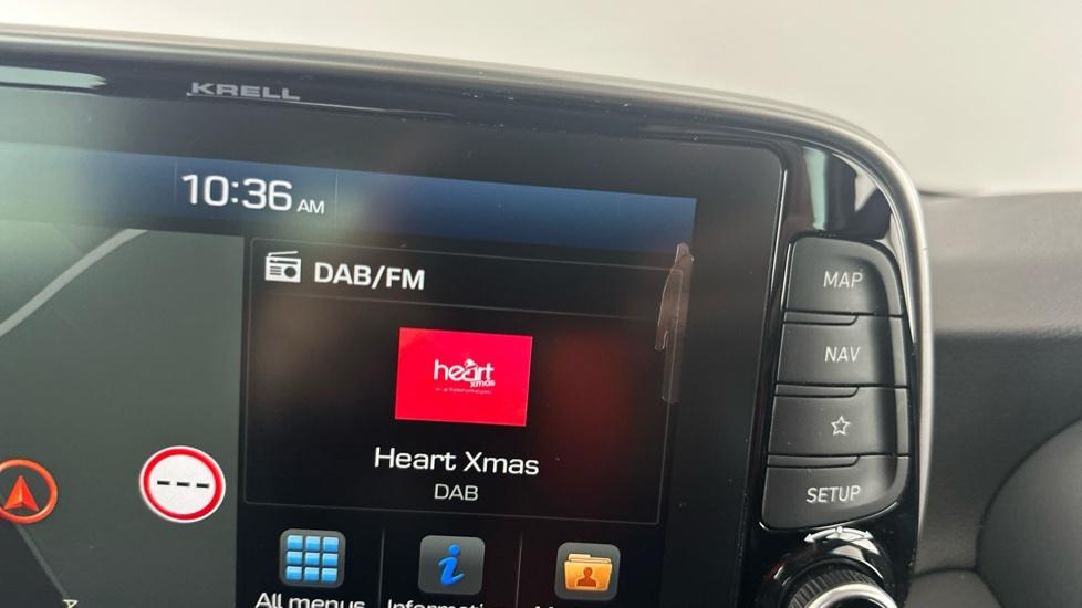 DAB Radio