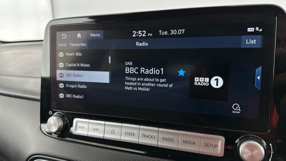 DAB Radio