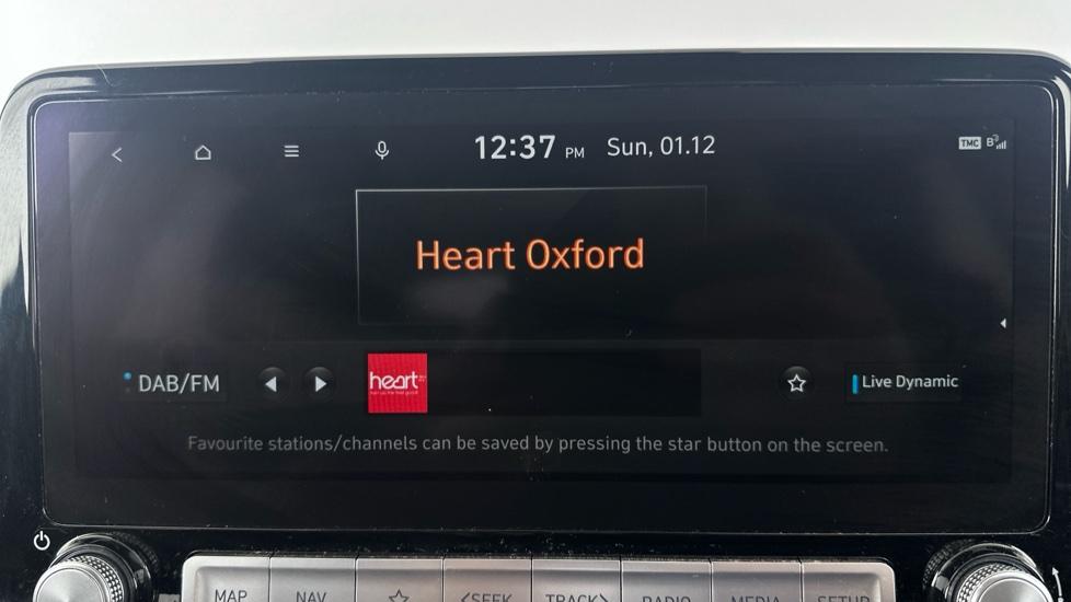 DAB Radio