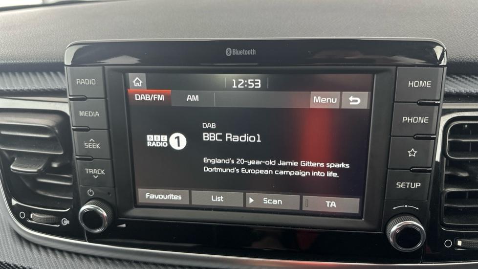 DAB Radio