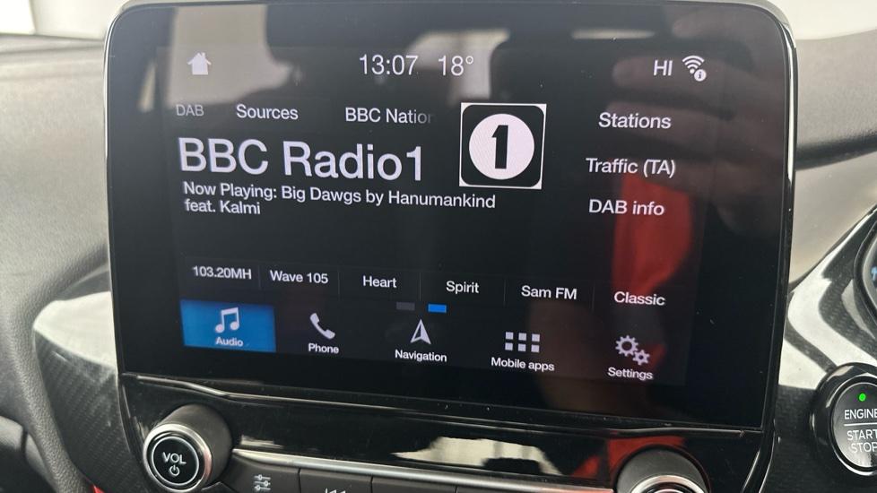 DAB Radio