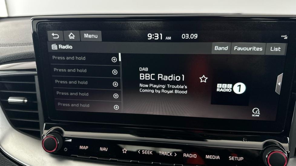 DAB Radio