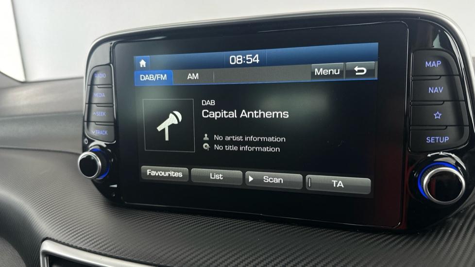 DAB Radio