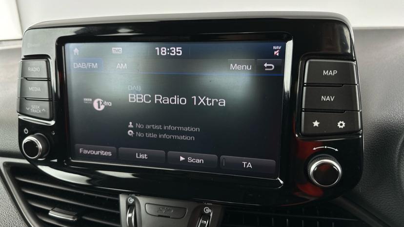 DAB Radio