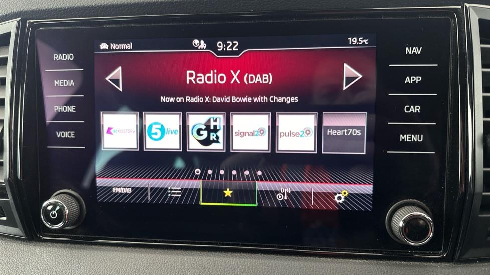 DAB Radio