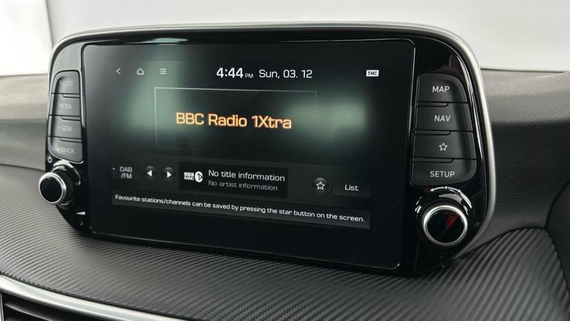 DAB Radio