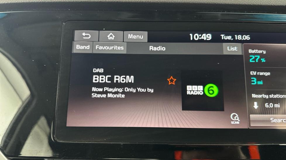 DAB Radio