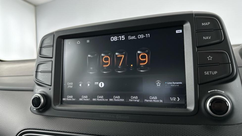 DAB Radio