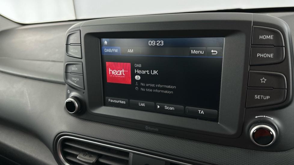 DAB Radio