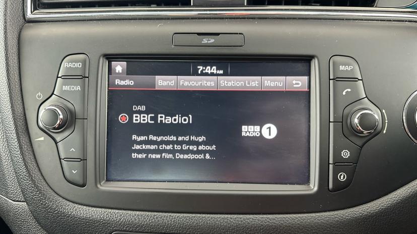 DAB Radio