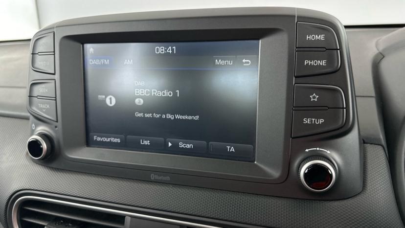 DAB Radio