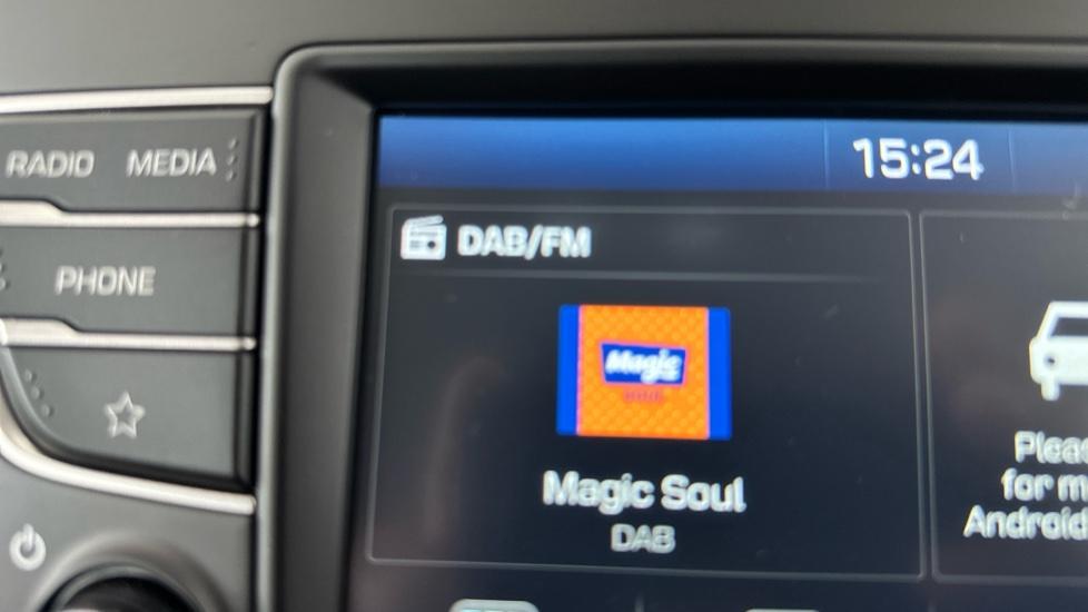 DAB Radio