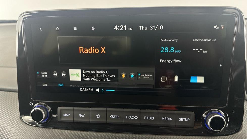 DAB Radio