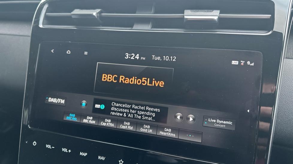 DAB Radio