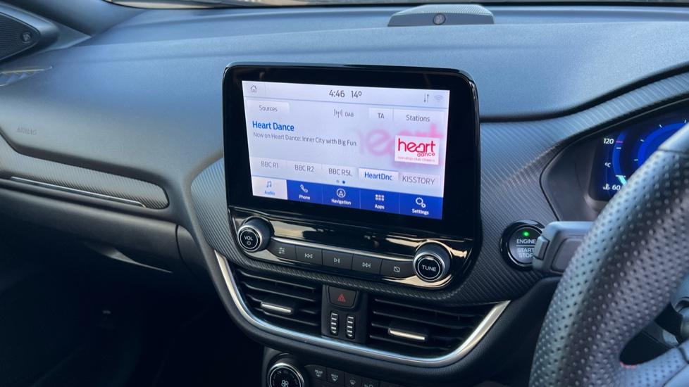 DAB Radio