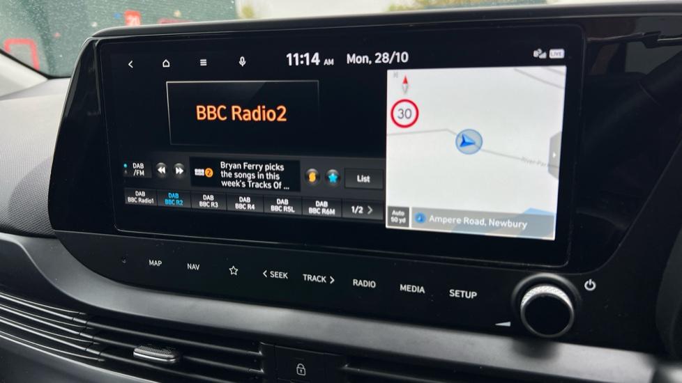 DAB Radio