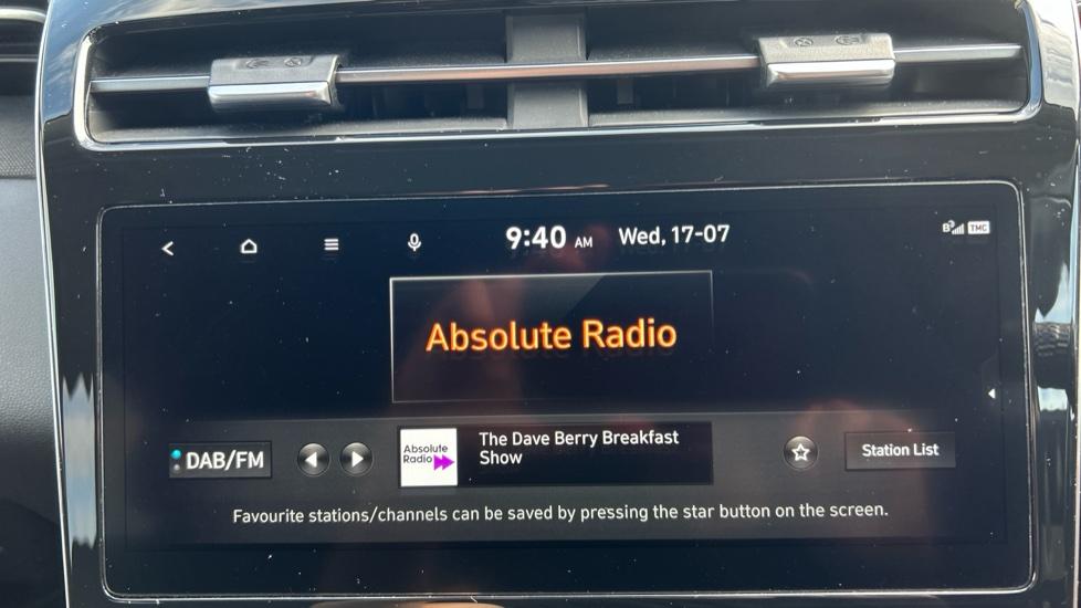 DAB Radio