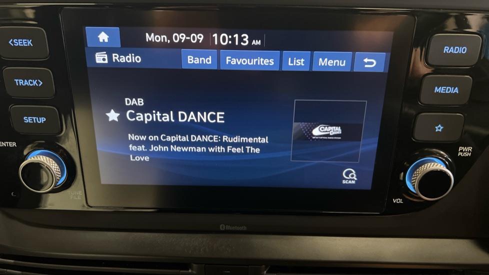 DAB Radio