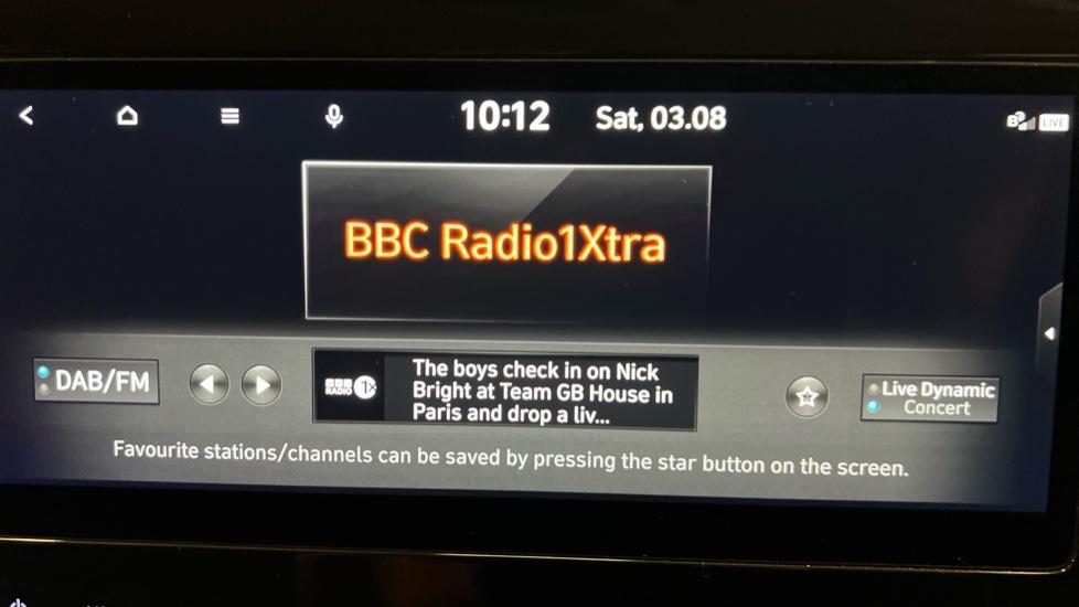 DAB Radio