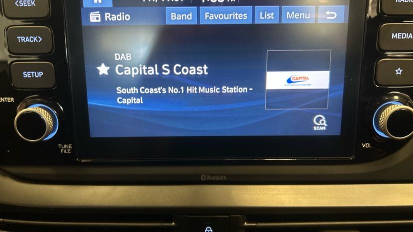 DAB Radio