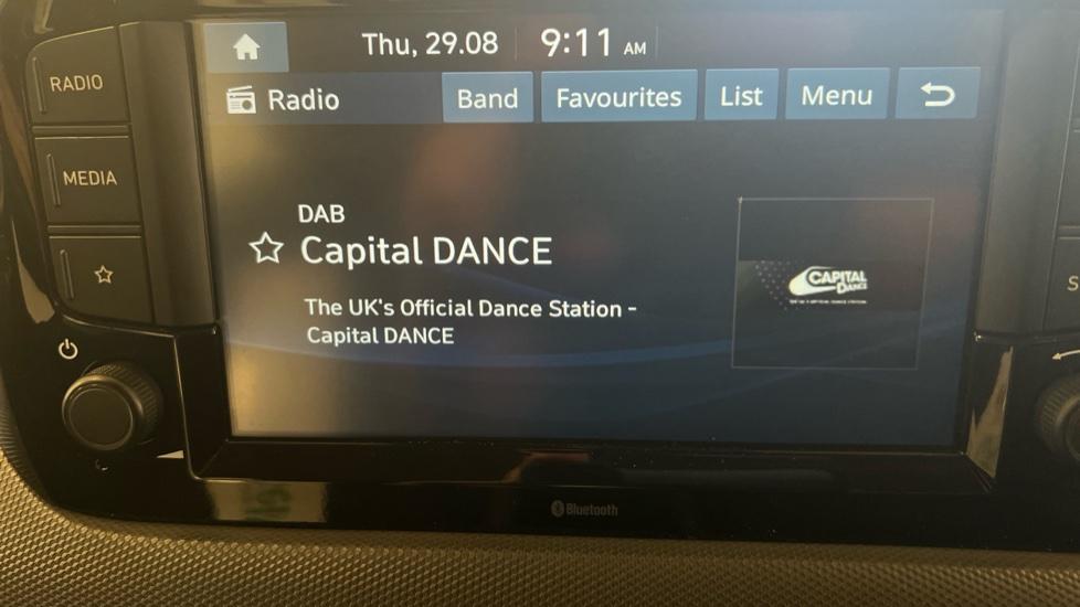 DAB Radio