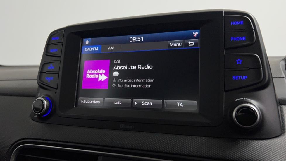 DAB Radio