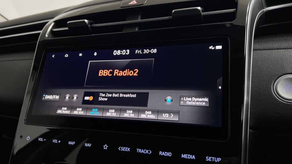 DAB Radio