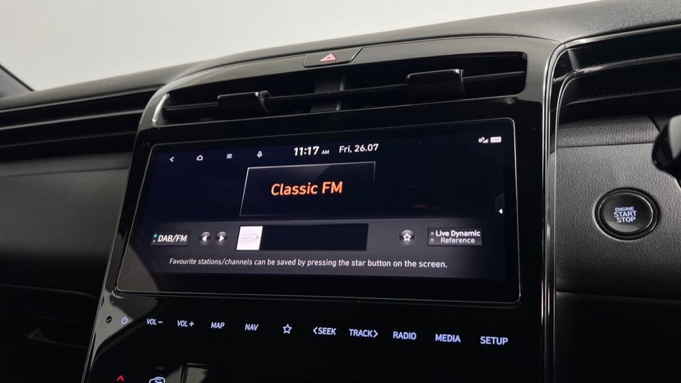 DAB Radio