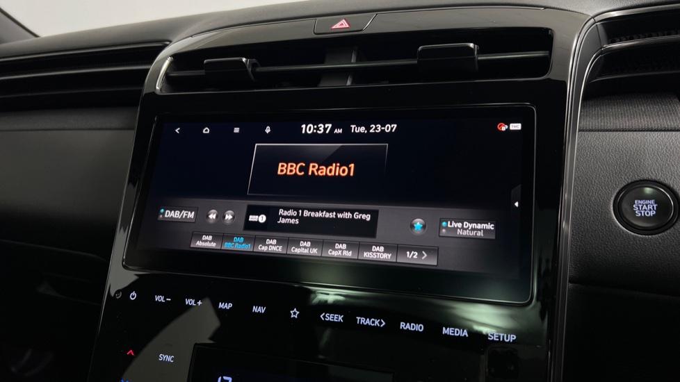 DAB Radio